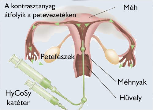 Petevezeték átjárhatósági vizsgálat
