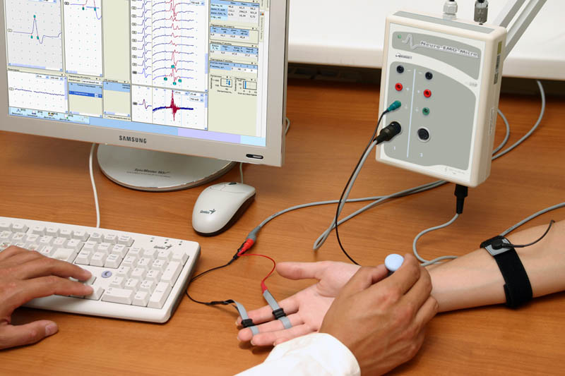 Hogyan diagnosztizálható a kéztő alagút szindróma?