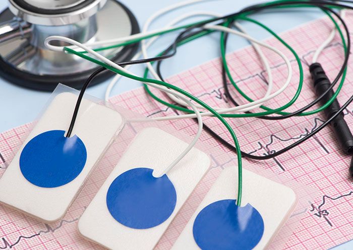 Nyugalmi EKG