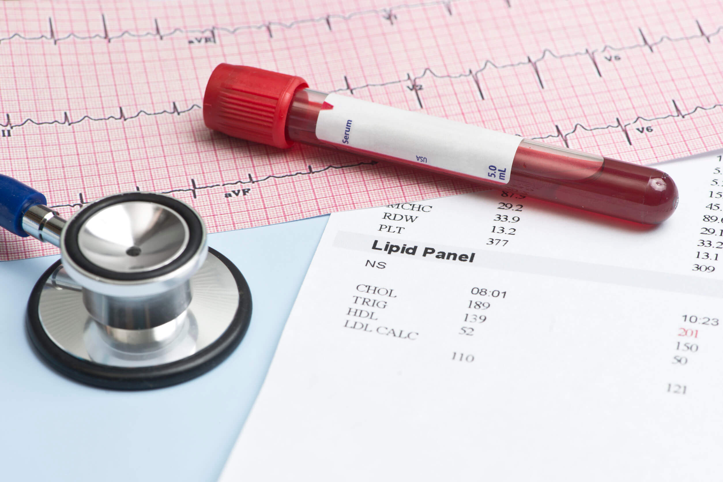 Lipid
