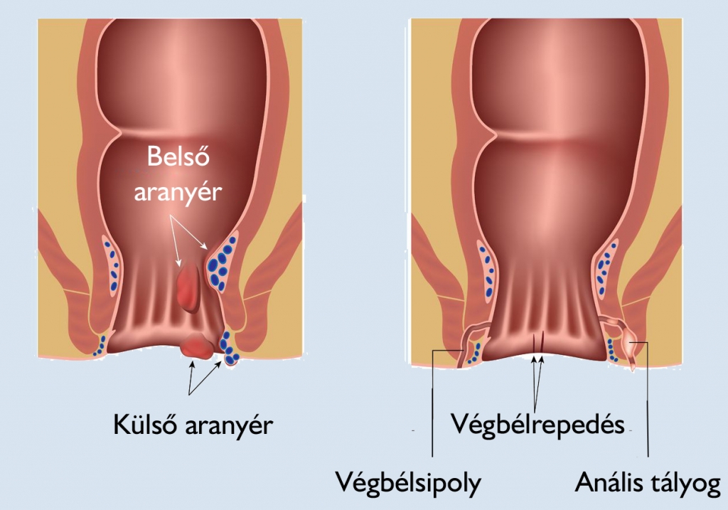 Proktológus szakrendelés