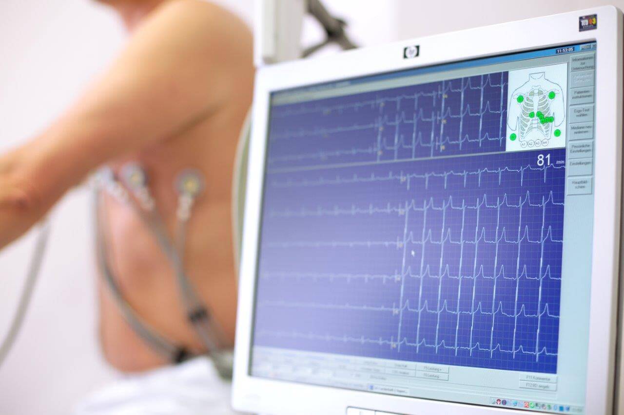 Terheléses EKG