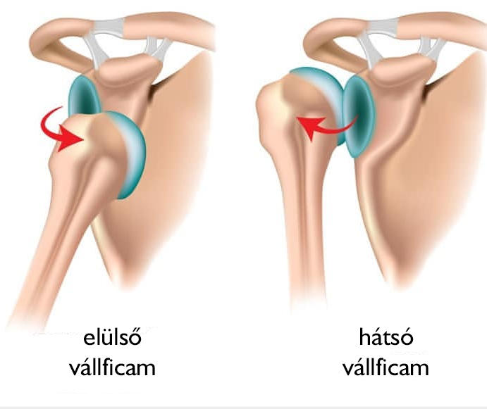 Vállízületi ficam