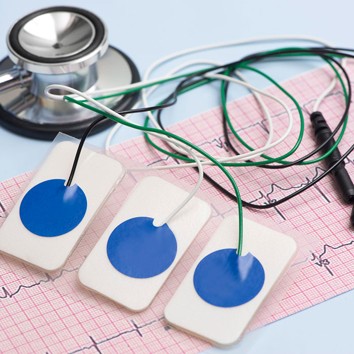 ekg
