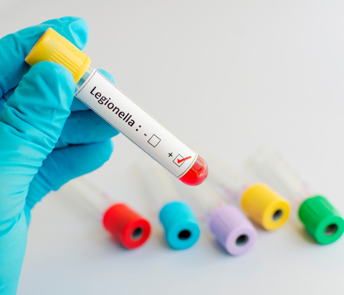 legionella