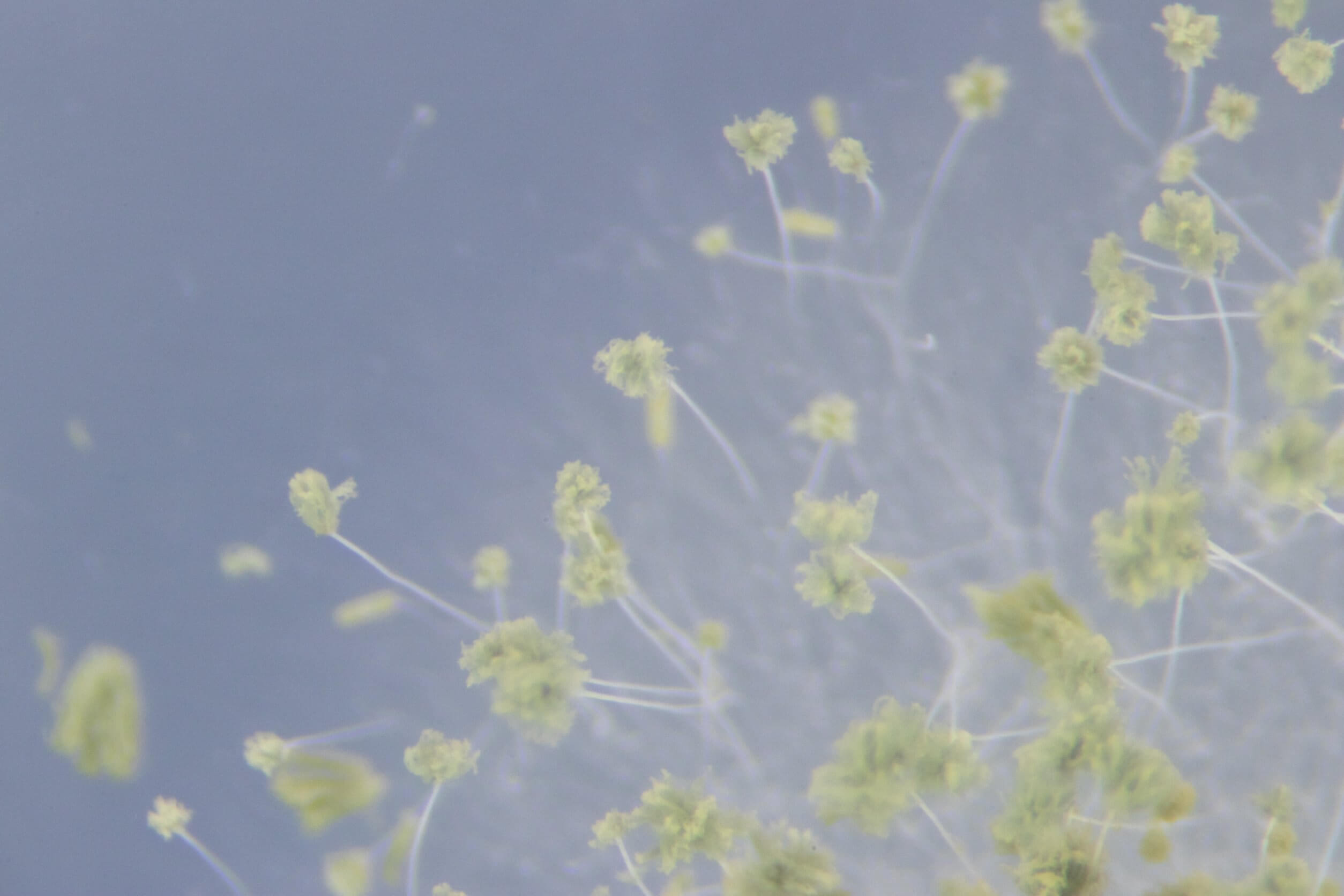 Aspergillus gomba