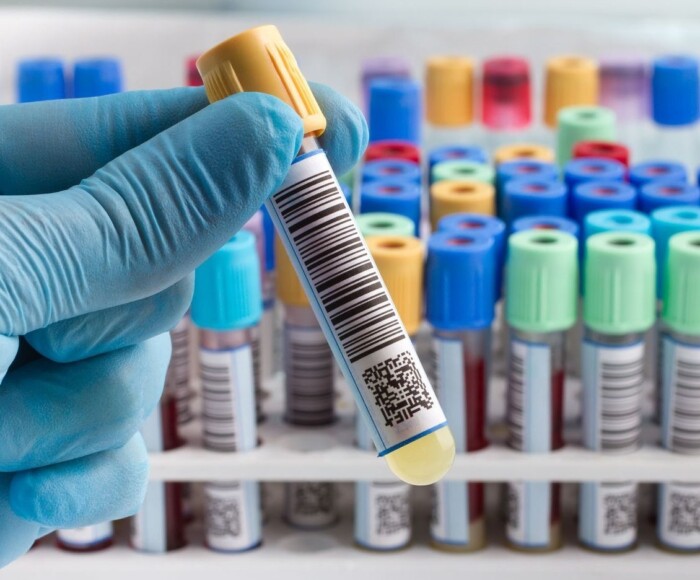 Laboratóriumi vizsgálatok a Medicare-nél