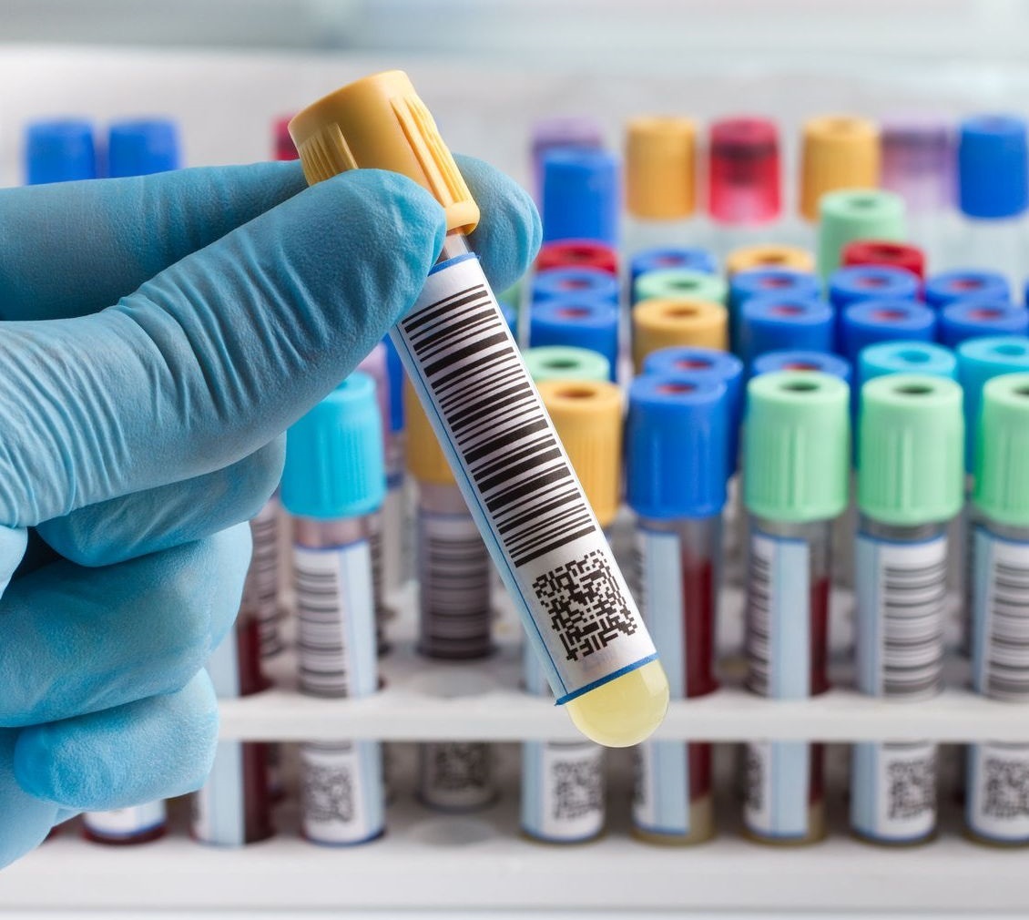 Laboratóriumi vizsgálatok a Medicare-nél