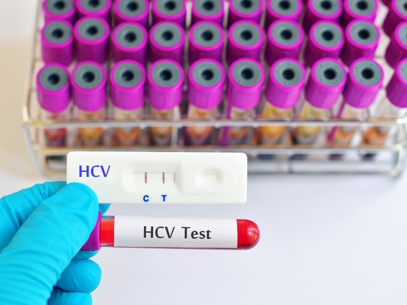 hcv-teszt